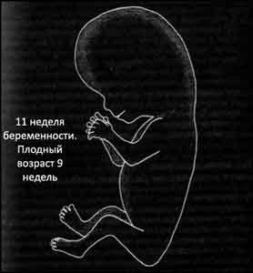 Беременность как лежит плод Беременность как лежит плод