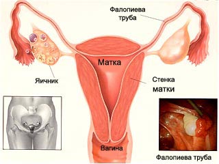 женские половые органы, менструальный цикл, менструация, схема